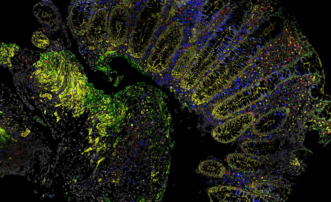 Exploring the world of bioimaging analysis: A new graduate-level course offering