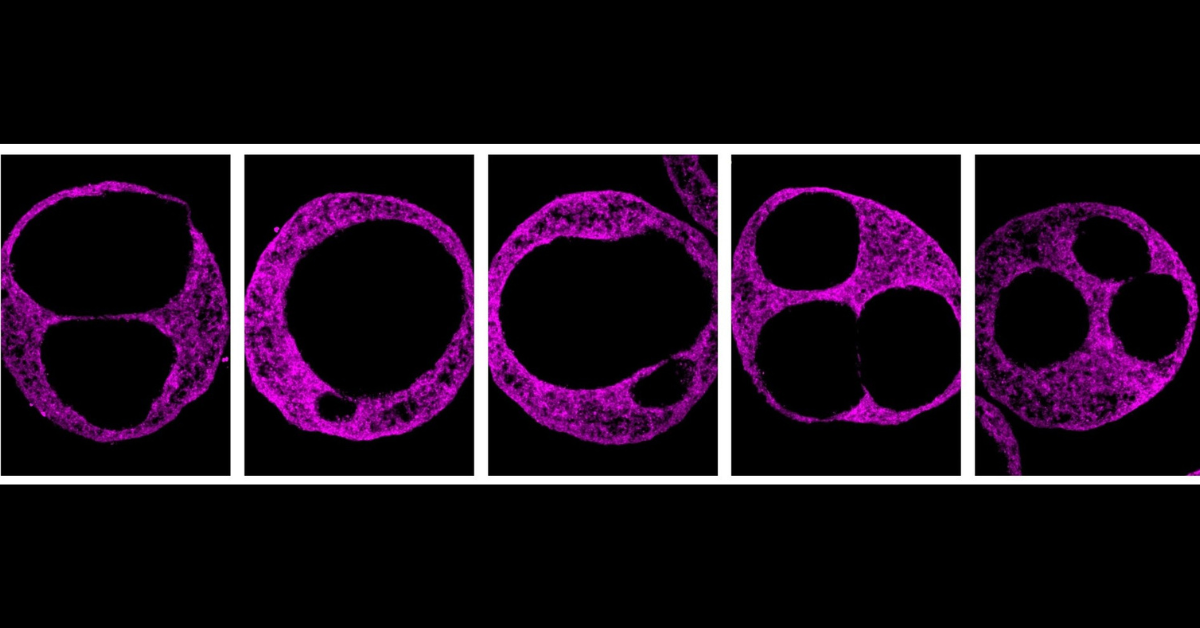 lab made image of human heart cardioid